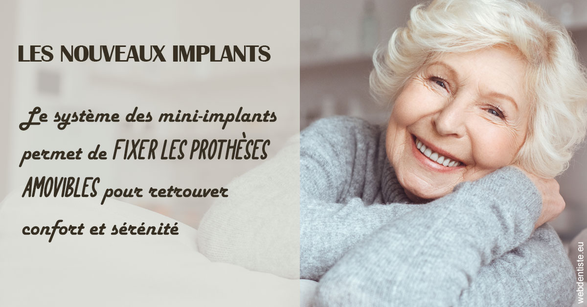 https://dr-eric-dumolard.chirurgiens-dentistes.fr/Les nouveaux implants 1