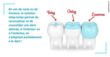 https://dr-eric-dumolard.chirurgiens-dentistes.fr/L'INLAY ou l'ONLAY