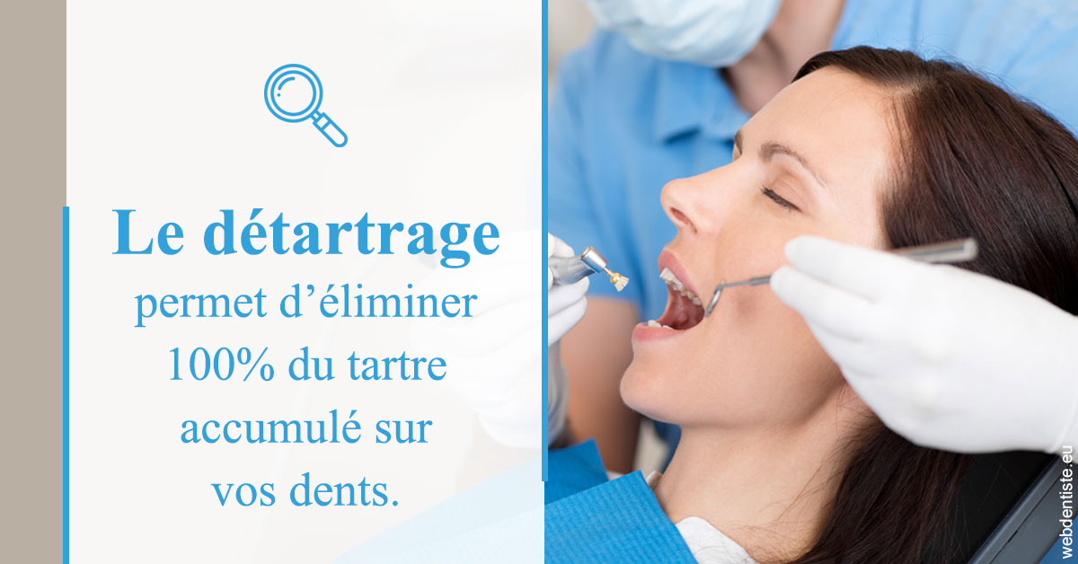 https://dr-eric-dumolard.chirurgiens-dentistes.fr/En quoi consiste le détartrage