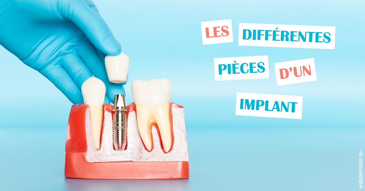 https://dr-eric-dumolard.chirurgiens-dentistes.fr/Les différentes pièces d’un implant 2