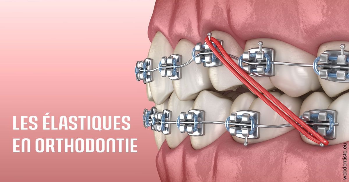 https://dr-eric-dumolard.chirurgiens-dentistes.fr/Elastiques orthodontie 2