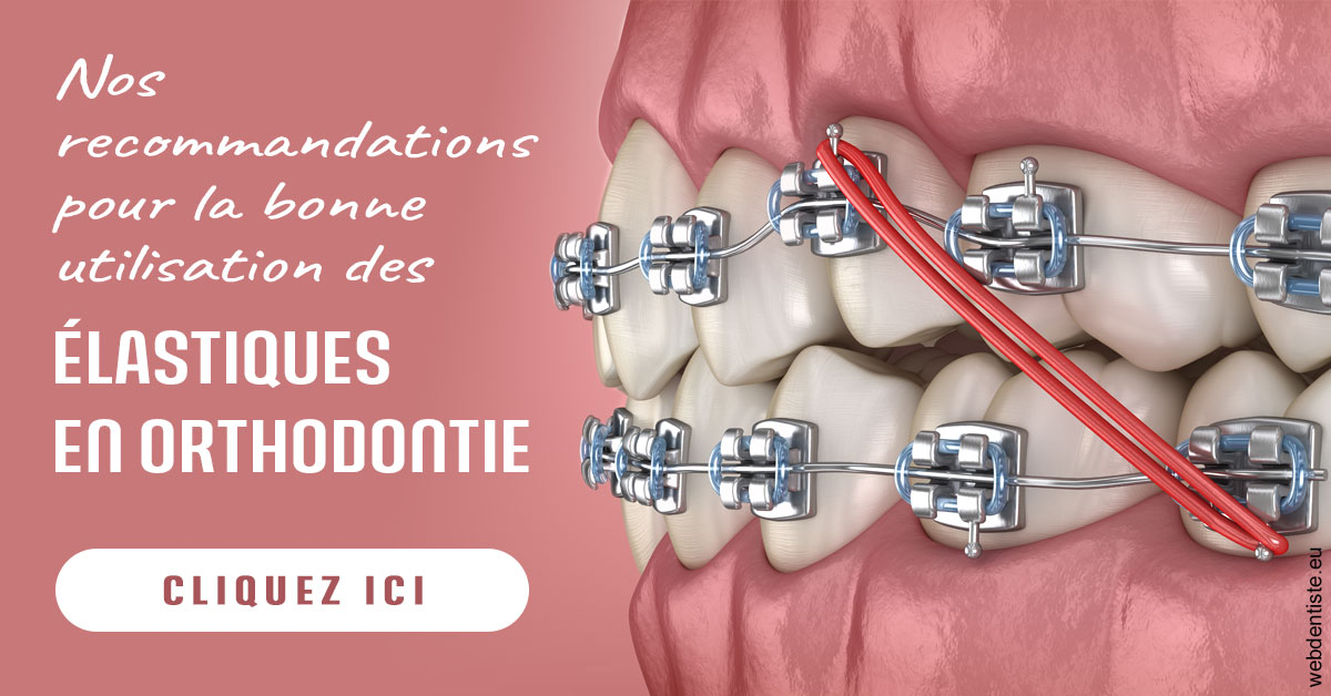 https://dr-eric-dumolard.chirurgiens-dentistes.fr/Elastiques orthodontie 2